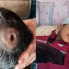 تربية صلاح الدين: سحب يد معلم ضرب تلميذا بالخاتم وثقب جمجمته